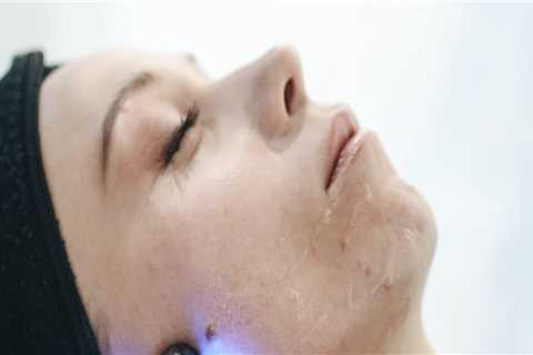 Importance Of Visiting The Best Medical Spa In Nashville For Your Hydrafacial Treatment