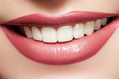 Natures Smile Reviews - A Natural solution for Gum Regrowth - Healthy Diet Site