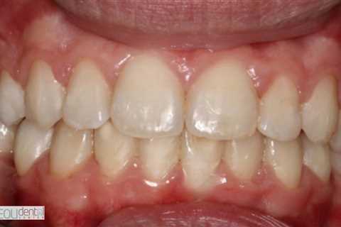 Standard post published to Symeou Dental Center at November 08, 2023 09:00