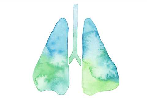 TKI Drug Plus Chemotherapy May Improve Lung Cancer Outcomes