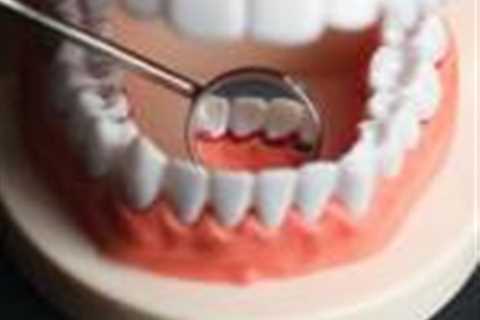 Periodontal treatment patients