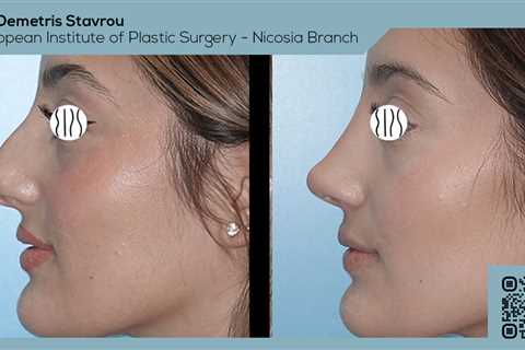 Standard post published to Dr. Demetris Stavrou - European Institute of Plastic Surgery - Nicosia..