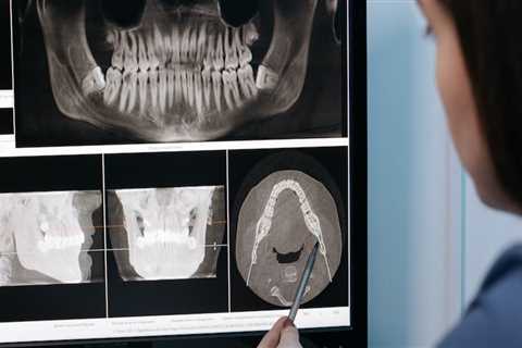 The Importance Of Dental X-Rays: How Implant Dentists In Manassas Park Are Revolutionizing Oral..