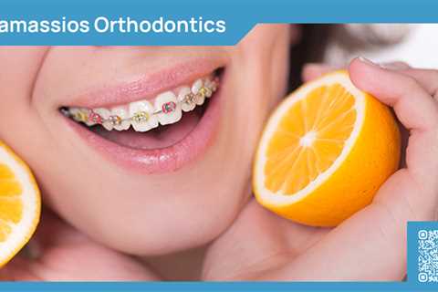 Standard post published to Tamassios Orthodontics - Orthodontist Nicosia, Cyprus at January 15,..