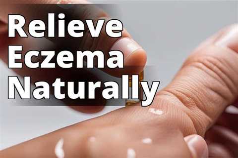 Unlocking the Healing Power: CBD Oil’s Benefits for Eczema Treatment