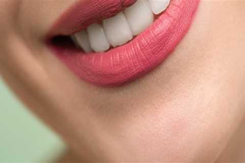 Smile Makeovers In San Antonio: The Role Of Dental And Cosmetic Dentistry