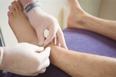 HOW TO USE ACUPUNCTURE FOR FOOT PAIN RELIEF