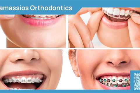 Standard post published to Tamassios Orthodontics - Orthodontist Nicosia, Cyprus at February 01,..