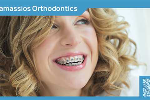 Standard post published to Tamassios Orthodontics - Orthodontist Nicosia, Cyprus at February 08,..