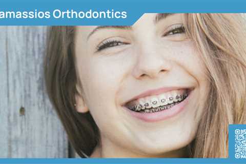 Standard post published to Tamassios Orthodontics - Orthodontist Nicosia, Cyprus at February 10,..