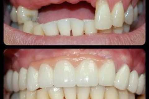 Let's replace those missing teeth....  Call/WhatsApp us on 0823900130 visit any…