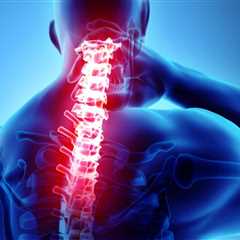 What does severe neck pain indicate?