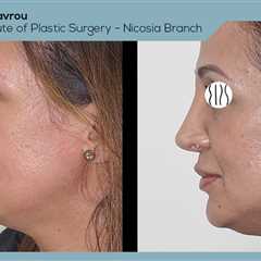 Standard post published to Dr. Demetris Stavrou - European Institute of Plastic Surgery - Nicosia..