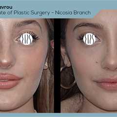 Standard post published to Dr. Demetris Stavrou - European Institute of Plastic Surgery - Nicosia..