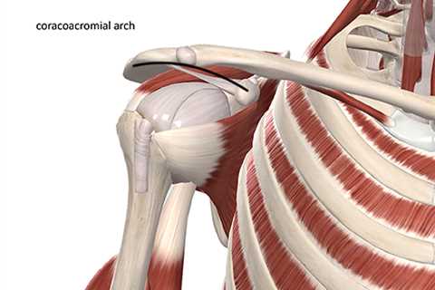 Is That A Supraspinatus Or Subscapularis Issue?