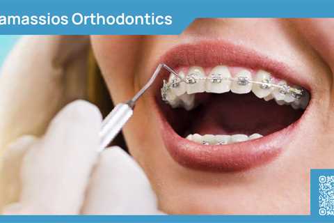 Standard post published to Tamassios Orthodontics - Orthodontist Nicosia, Cyprus at March 19, 2024..