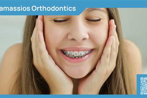 Standard post published to Tamassios Orthodontics - Orthodontist Nicosia, Cyprus at March 25, 2024..