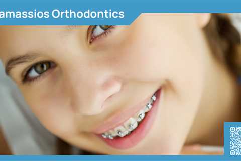 Standard post published to Tamassios Orthodontics - Orthodontist Nicosia, Cyprus at March 28, 2024..