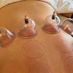 Unlock the Benefits of Cupping for Respiratory Health