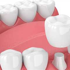 Temporary Crown is Sensitive Solutions - Best Dental Reviews