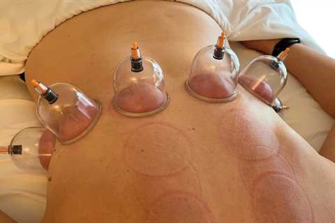 Unlock the Benefits of Cupping for Respiratory Health