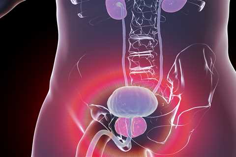 Prostate Cancer Cases Expected to Double by 2040, Study Finds
