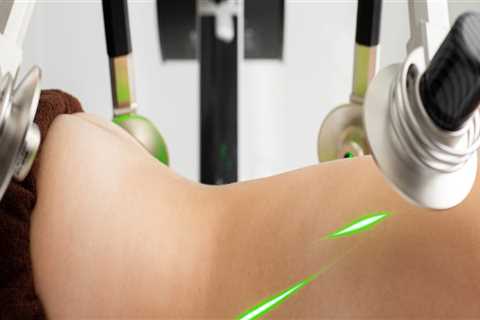 All About Laser Liposuction And Cold Laser Therapy In Stamford, CT