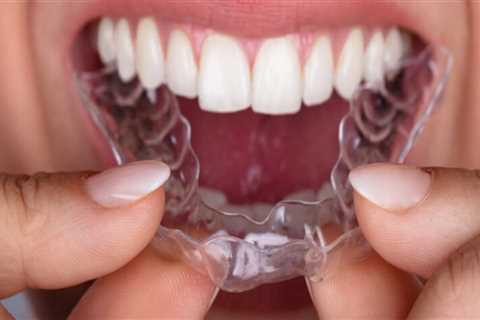 Invisible Confidence: The Power Of Invisalign Clear Braces In Kitsilano, Vancouver