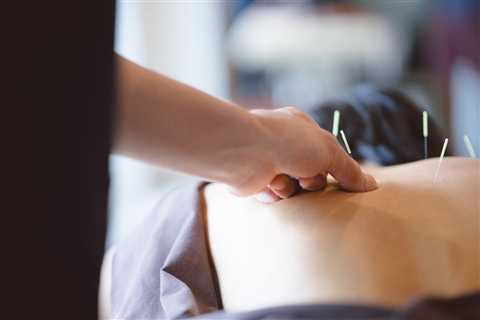 Understanding Traditional Chinese Medicine: The Role of Acupuncture