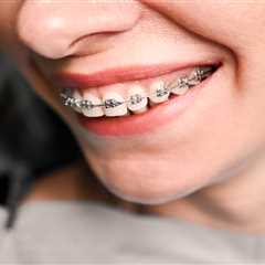 How to Keep Braces From Cutting Your Mouth