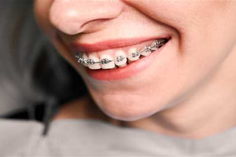 How to Keep Braces From Cutting Your Mouth