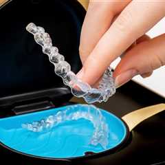 How to Clean Your Retainer the Right Way