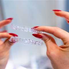 Best Way to Remove Clear Aligners with Attachments