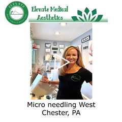 Micro needling West Chester, PA - Elevate Medical Aesthetics