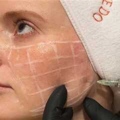 Revolutionizing Skincare: The Rise of Skinvive as a Game-Changer