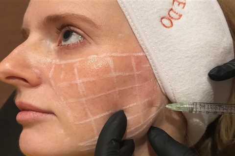 Revolutionizing Skincare: The Rise of Skinvive as a Game-Changer