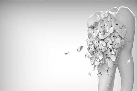 Elevate Your Smile with Dental Veneers and Dentofacial Orthopedics in Fort Walton Beach