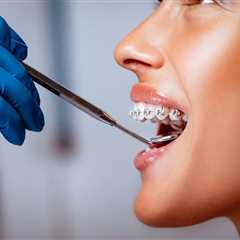 How to Handle Common Metal Braces Discomfort at Home