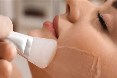 Exploring the Benefits of Chemical Peels in Medical Aesthetics