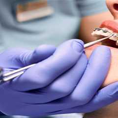 What Adults Should Know About Getting Traditional Metal Braces