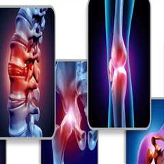 Understanding the Role of Medication in Arthritis Therapy