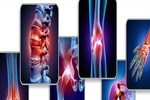 Understanding the Role of Medication in Arthritis Therapy