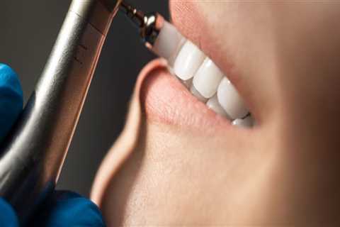 Understanding the Pain of Teeth Cleaning: What to Expect