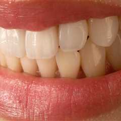 From Dental Veneers to Confident Smiles: Why Children Orthodontics Matters in Sacramento, CA